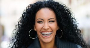 10 benefícios do aparelho dentário para o seu sorriso e sua saúde